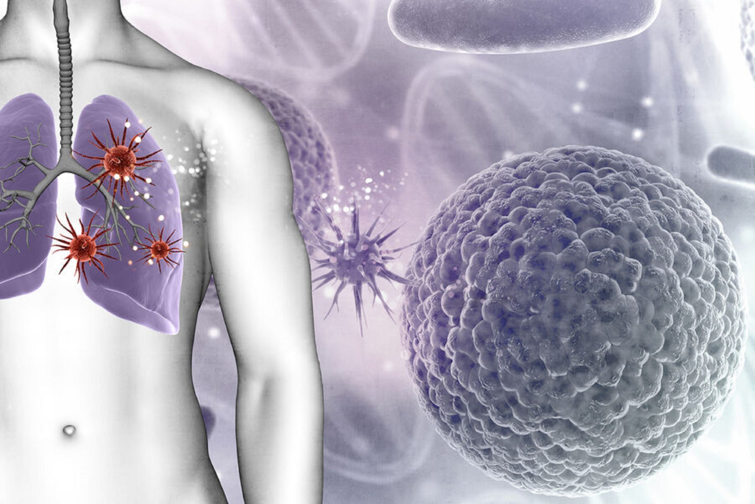 Симптоми раку легені - 8 найпоширеніших