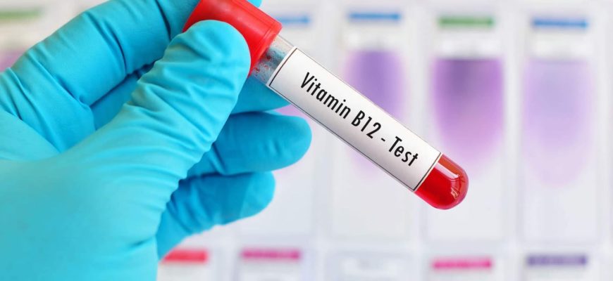 Анализ на витамин В12